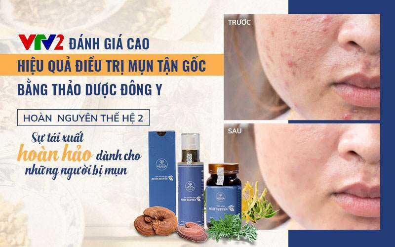 TOP 13+ Sản phẩm trị mụn đầu đen AN TOÀN, HIỆU QUẢ nhất các chuyên gia da liễu khuyên dùng - Trung tâm y tế dự phòng Bắc Kạn