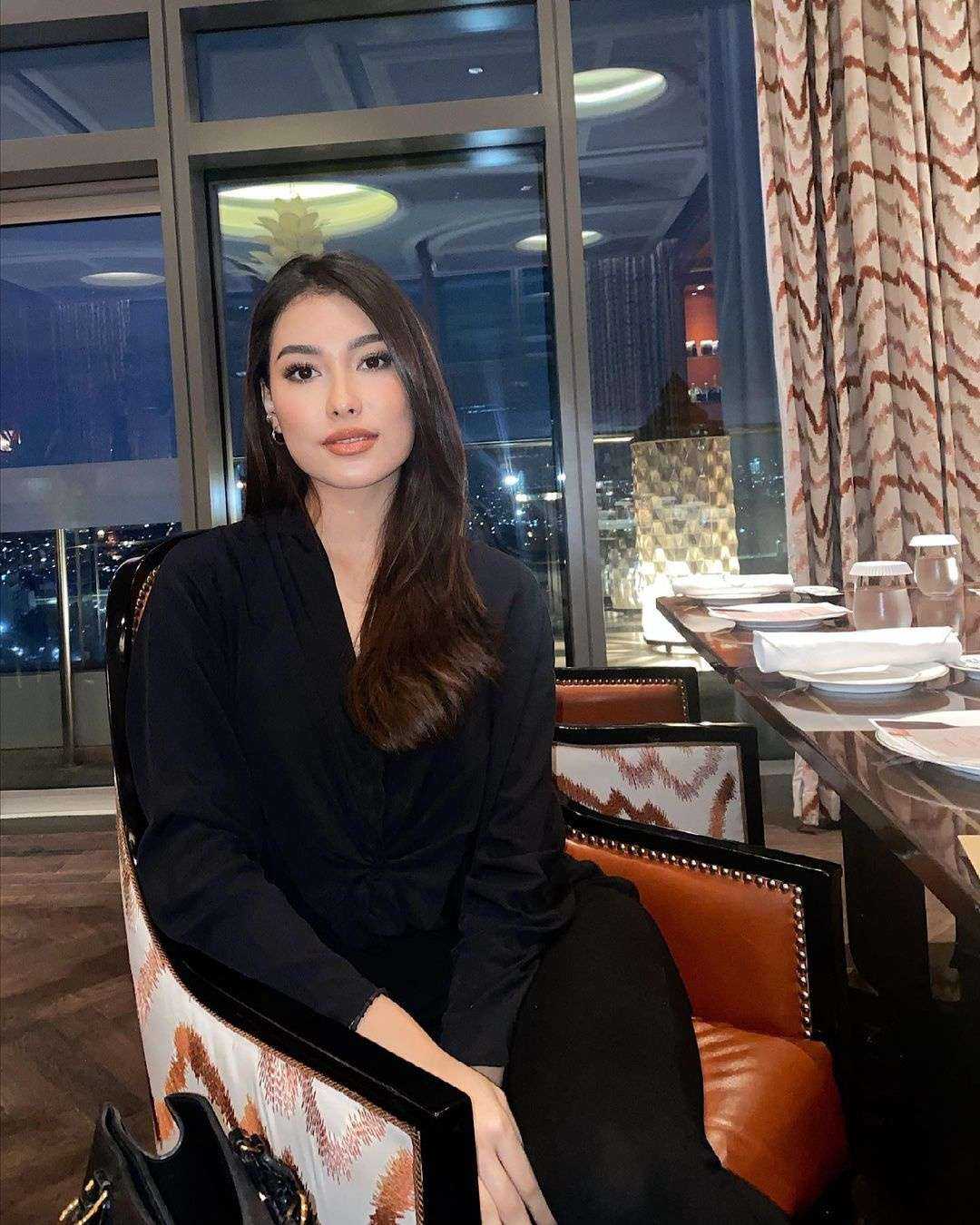 Hoa hậu Indonesia khốn khổ vì thẩm mỹ hỏng - ảnh 2