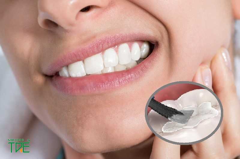  [Giải đáp] Tại sao hàn răng rồi vẫn đau? – Cách khắc phục