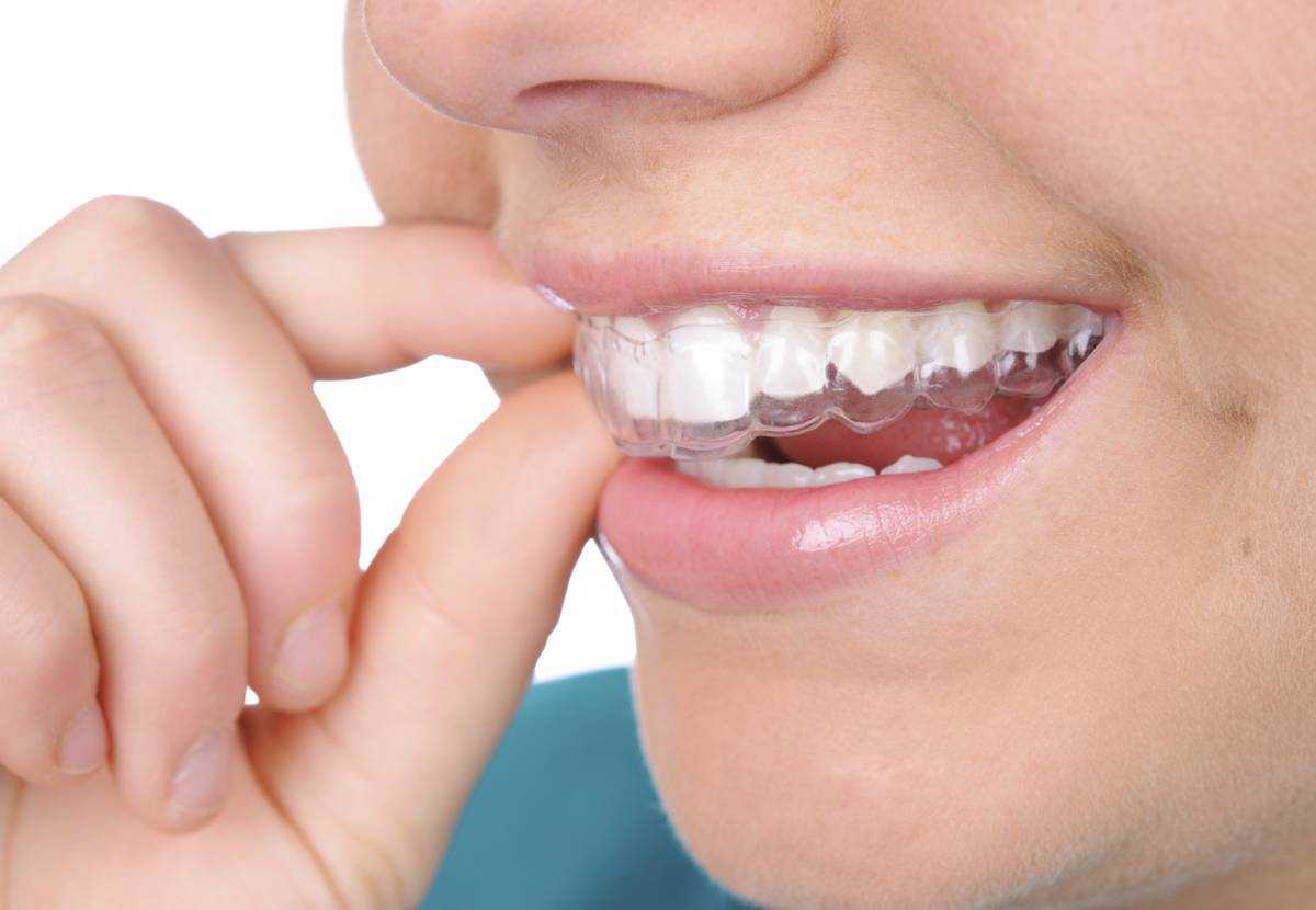 Top 10 Sản Phẩm Làm Trắng Răng tốt nhất hiện nay