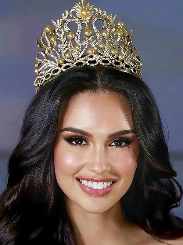 Đối thủ đáng gờm của Ngọc Châu tại Miss Universe bị phát tán ảnh đời tư-5