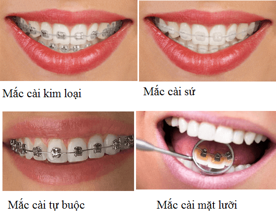 Nha Khoa Hải Bằng Thủ Đô Hà Nội