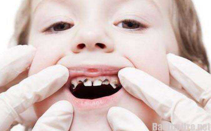 khám răng hàm mặt ở đâu tại tp vinh, khám răng hàm mặt cho bé ở đâu tại nghệ an, phòng khám răng hàm mặt uy tín ở vinh, phòng khám răng hàm mặt ngoài giờ ở vinh 9